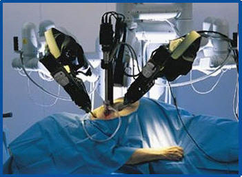 Here's what the robotic arms look like at the operating field