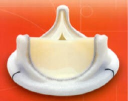 Edwards Lifesciences Bovine Pericardial (Cow Tissue) valve