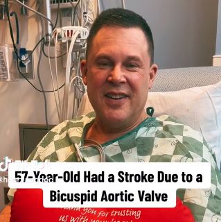 Stroke from Bicuspid Aortic Valve