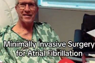 Minimally Invasive Surgery for Atrial Fibrillation