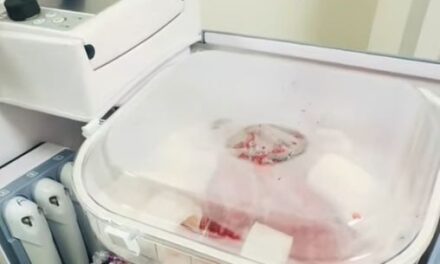 The Organ Care System (OCS)