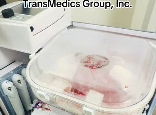 The Organ Care System (OCS)