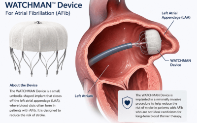 AFib Devices