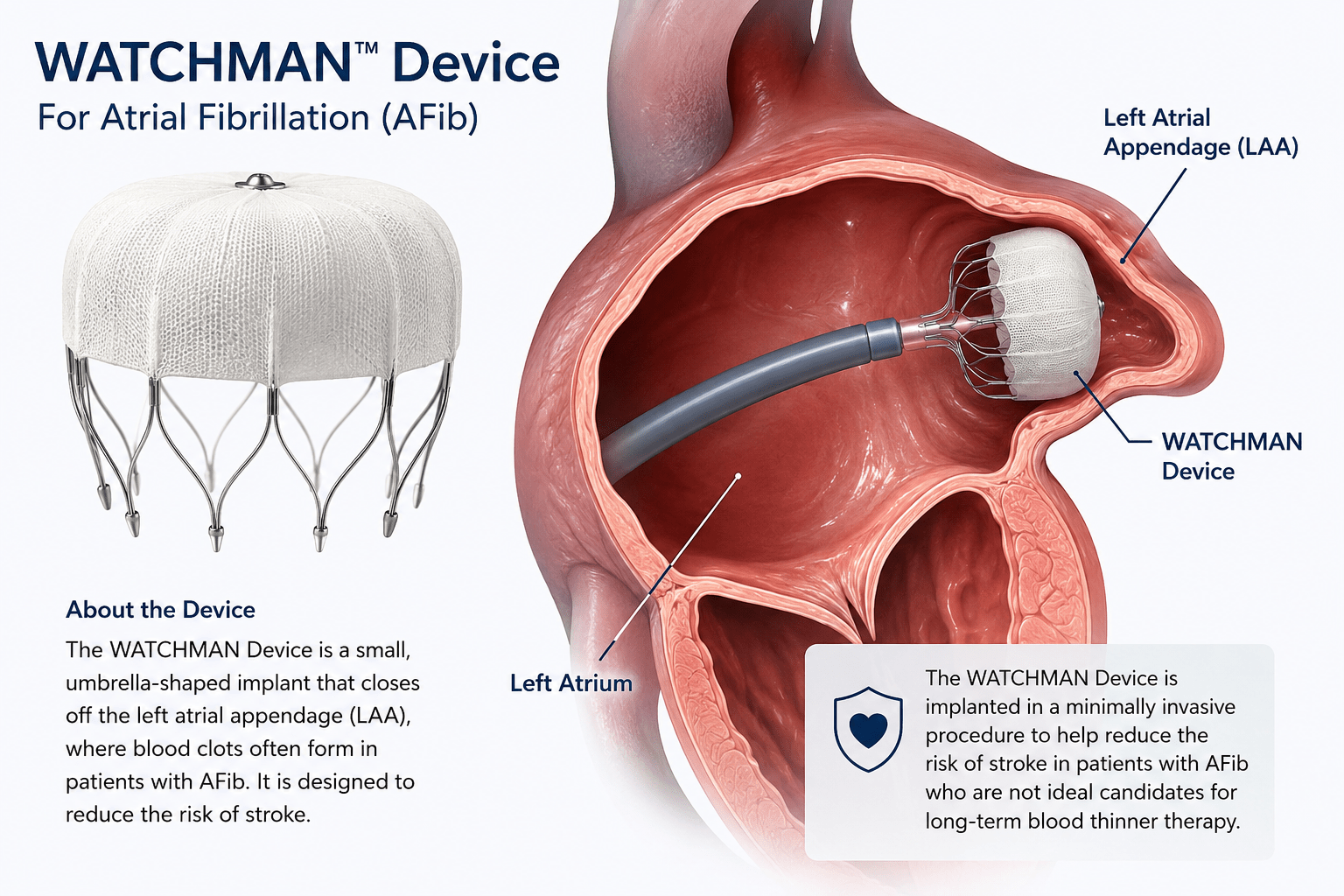 Watchman Device