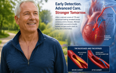How a Calcium Score to Bypass Surgery